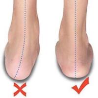 исправляю ноги👣 и осанку👤