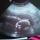 babygirlno3