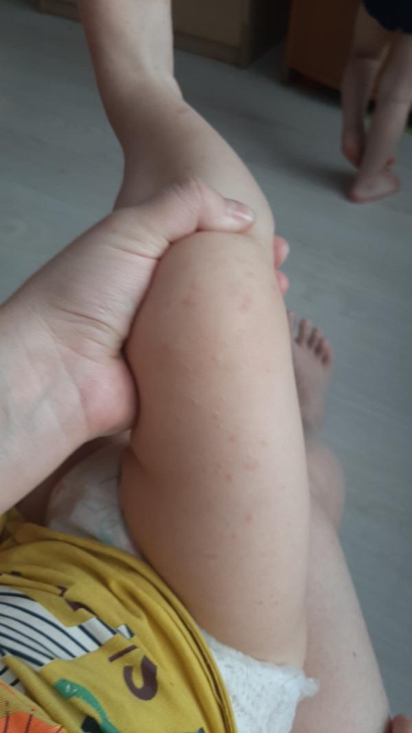 post image 2