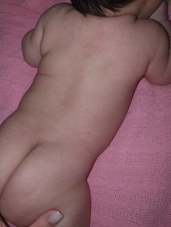post image 4