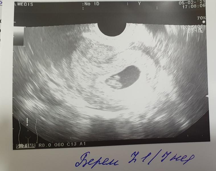post image 4