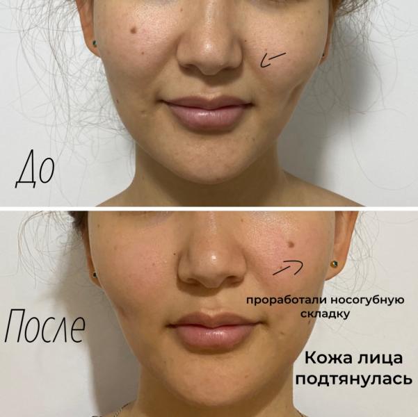 post image 4
