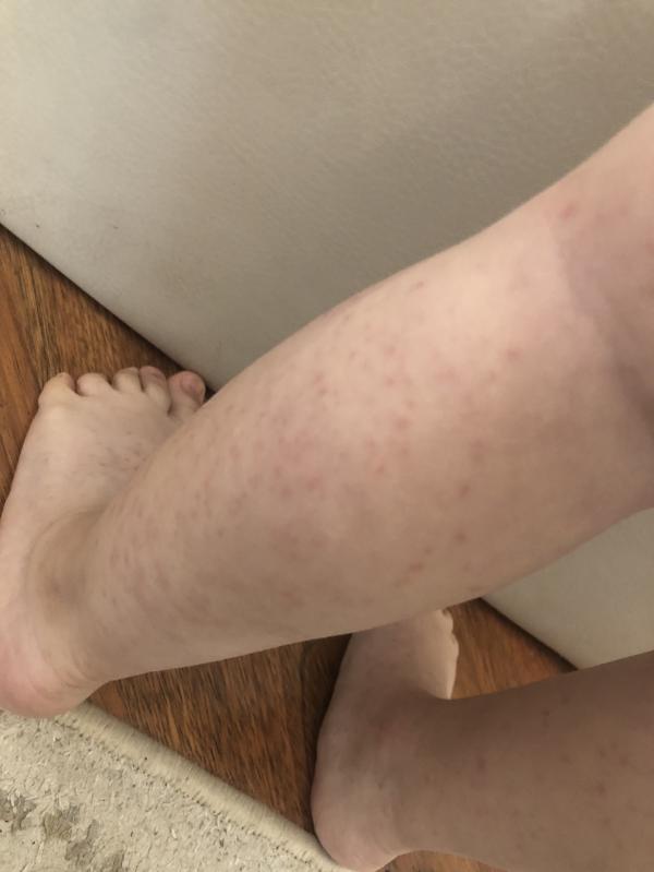 post image 4