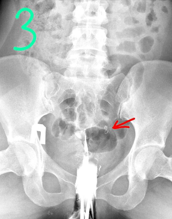 post image 3