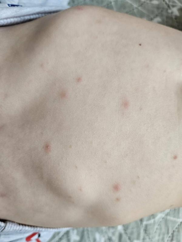 post image 2