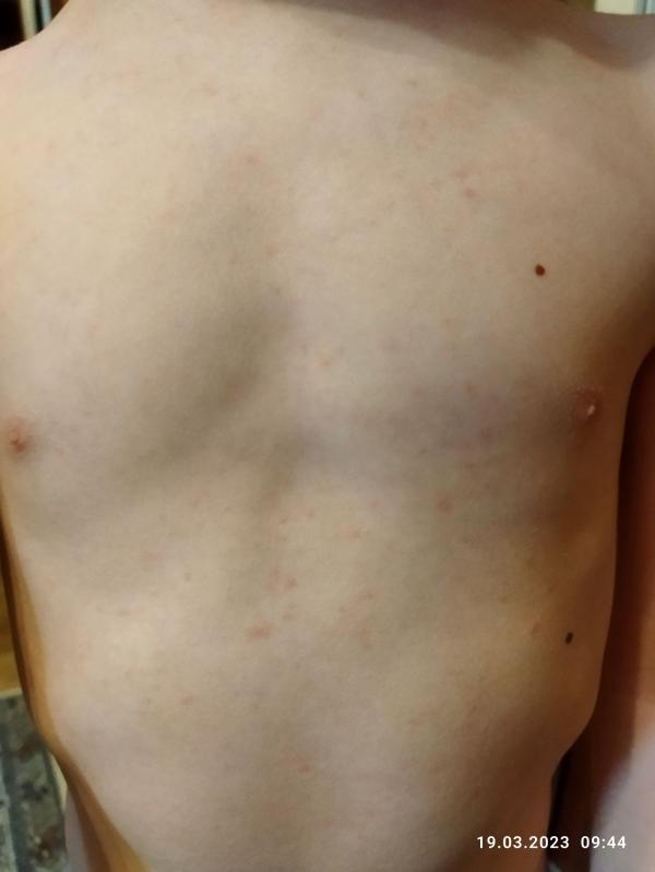 post image 1