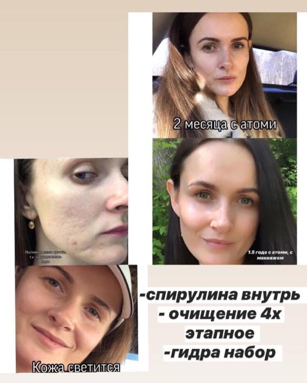 post image 4