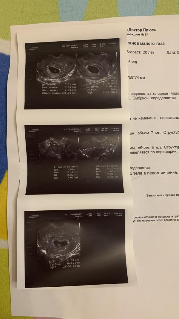 post image 4