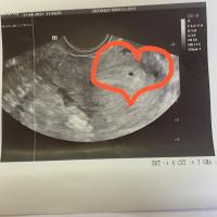 Туркан@Абдуллаева