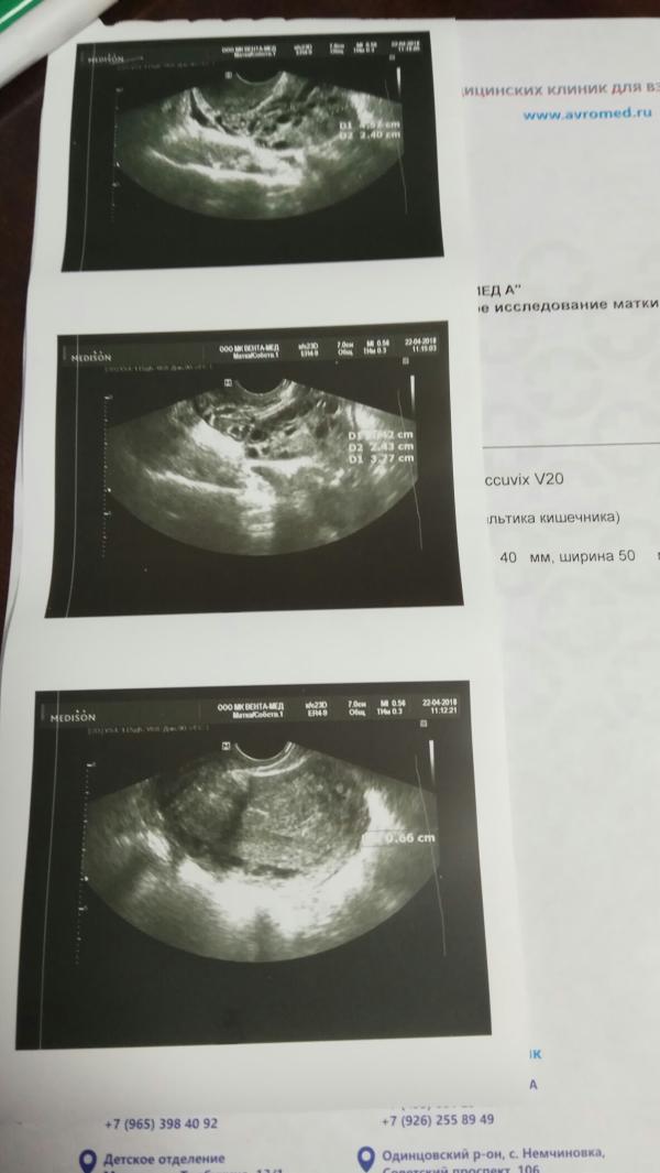 post image 3