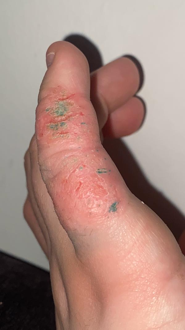 post image 1