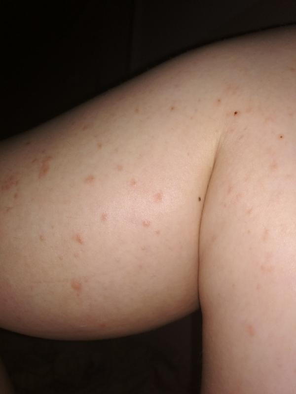 post image 2