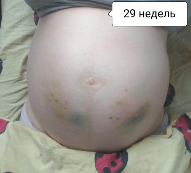 post image 4