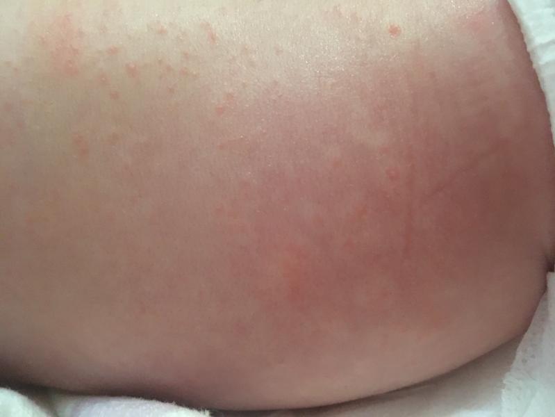 post image 4