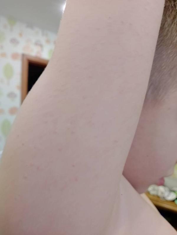 post image 3