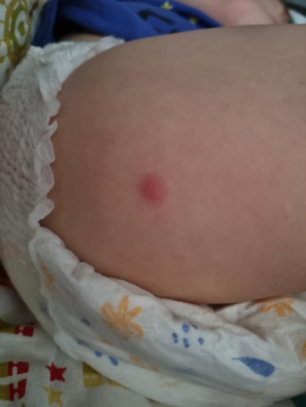 post image 2