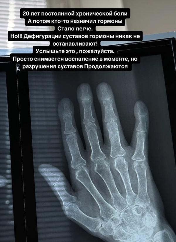 post image 4