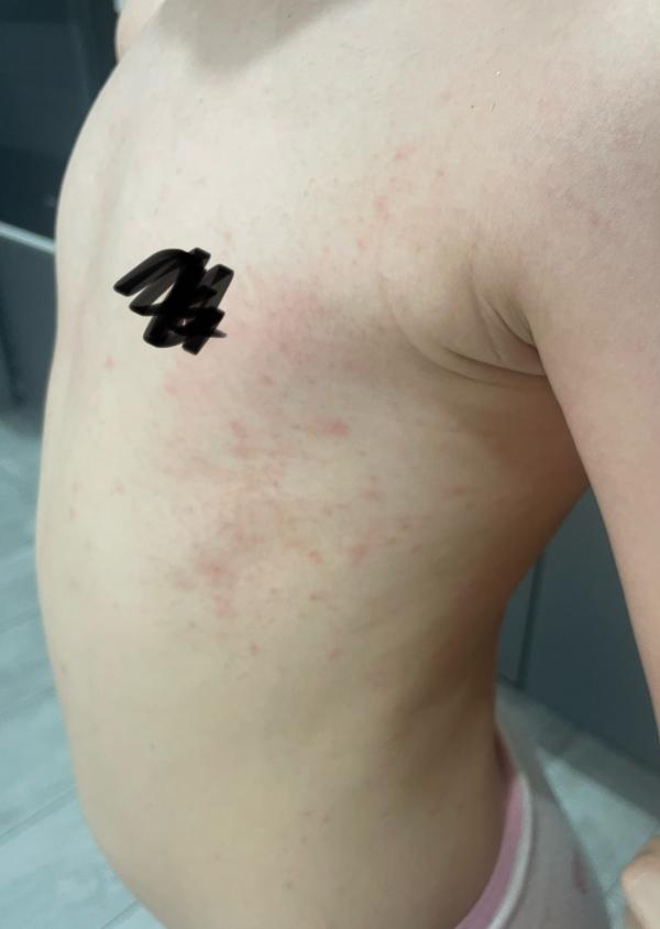 post image 2