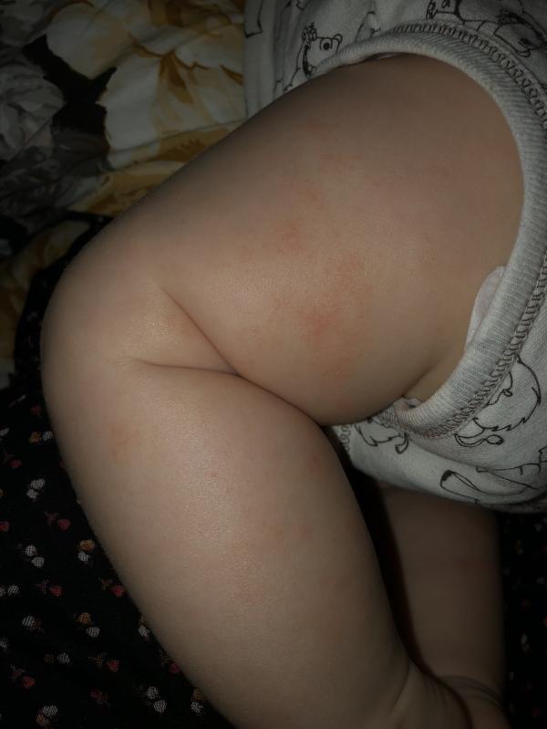 post image 4