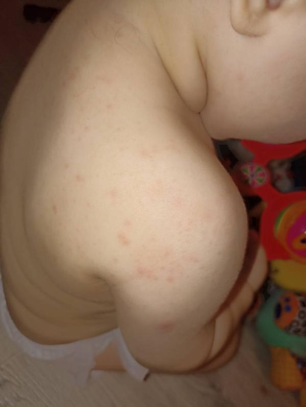 post image 2