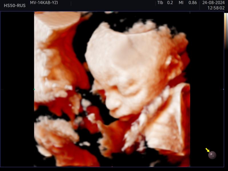 post image 4