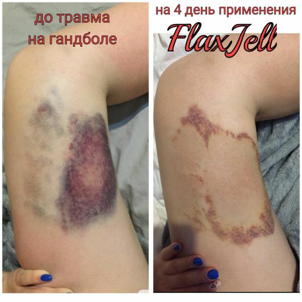 post image 5