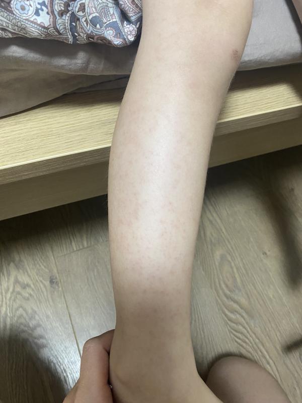 post image 5