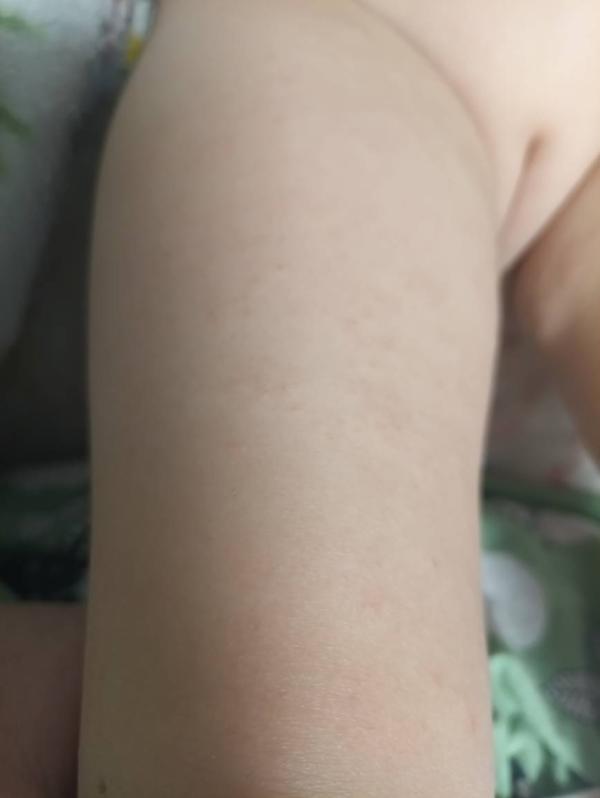 post image 5