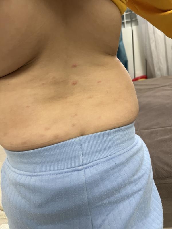 post image 2
