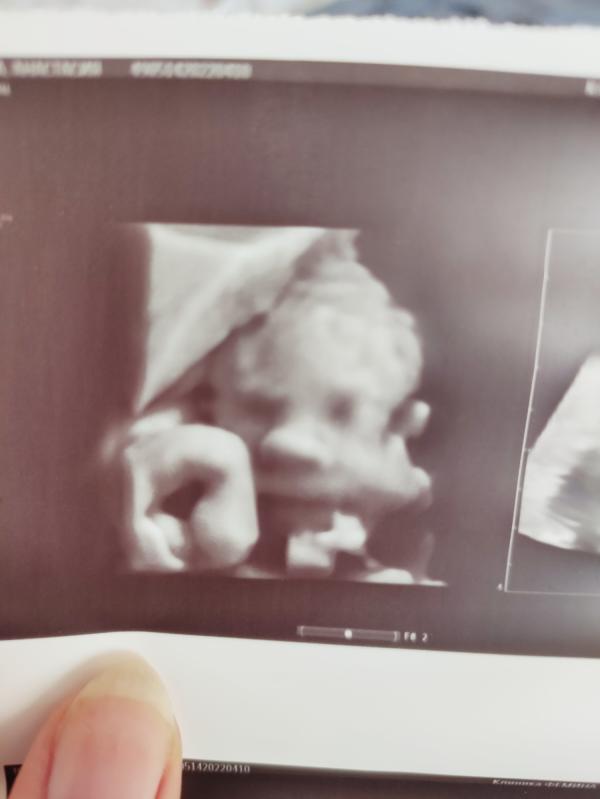 post image 4