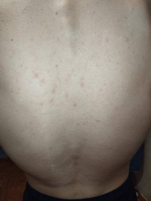 post image 1