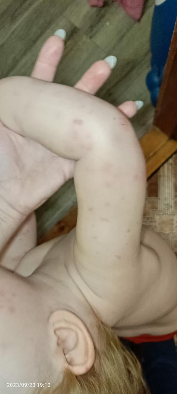 post image 4