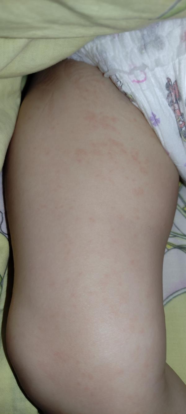 post image 4