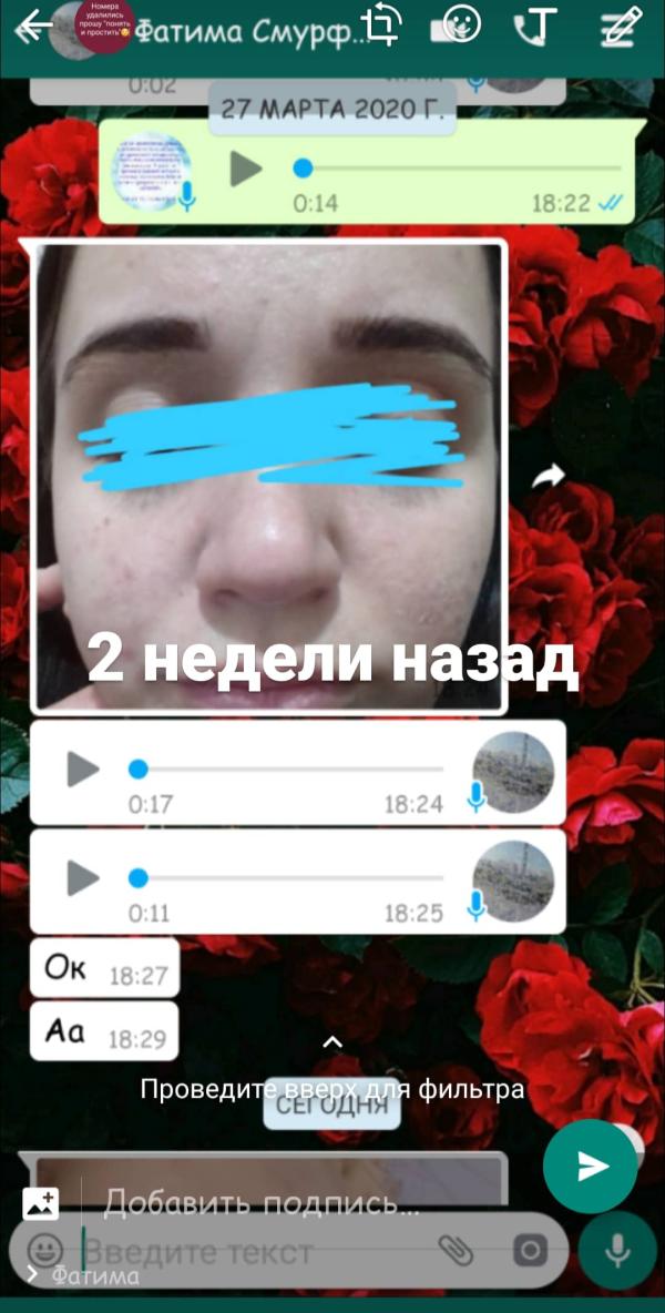 post image 4