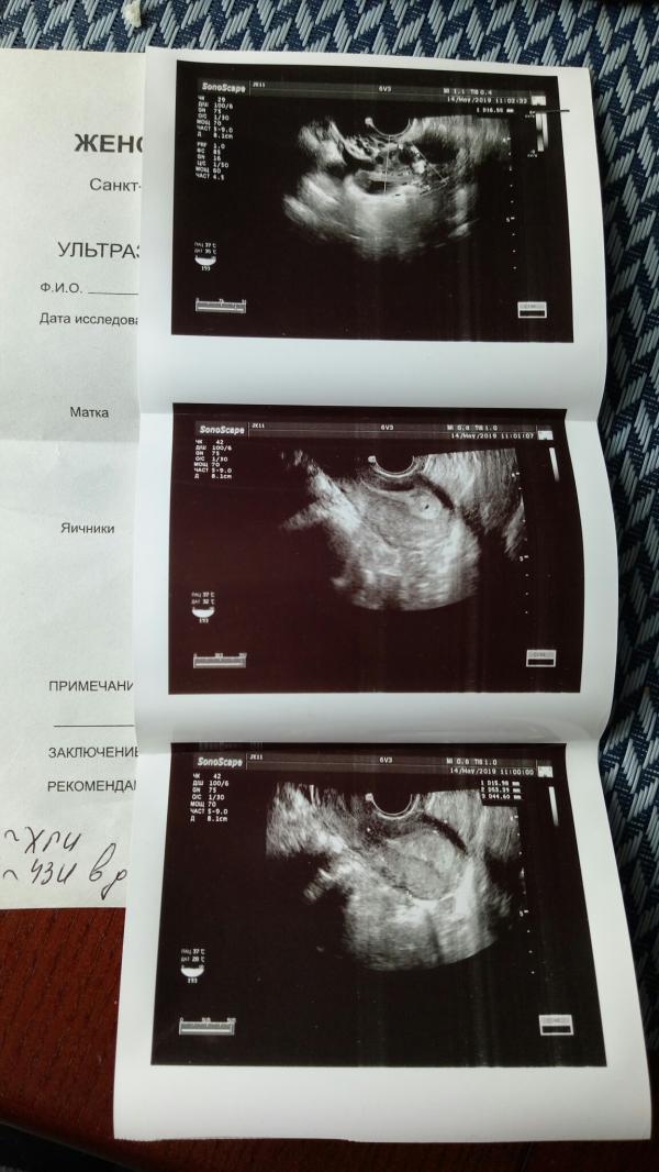 post image 3