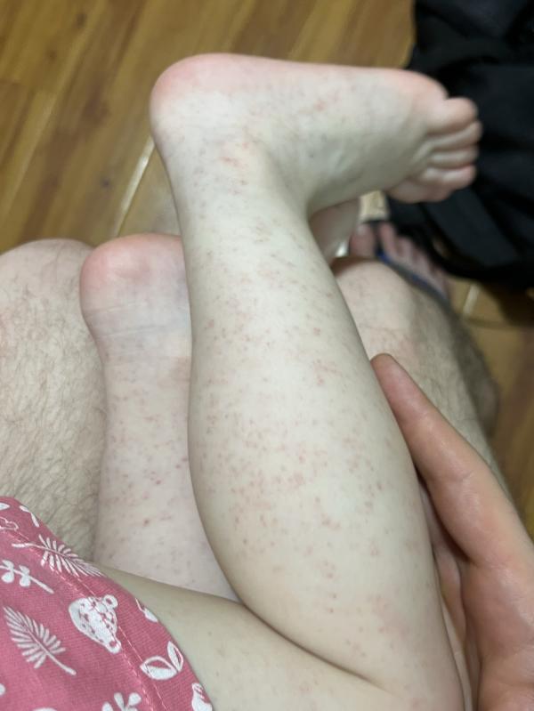 post image 3