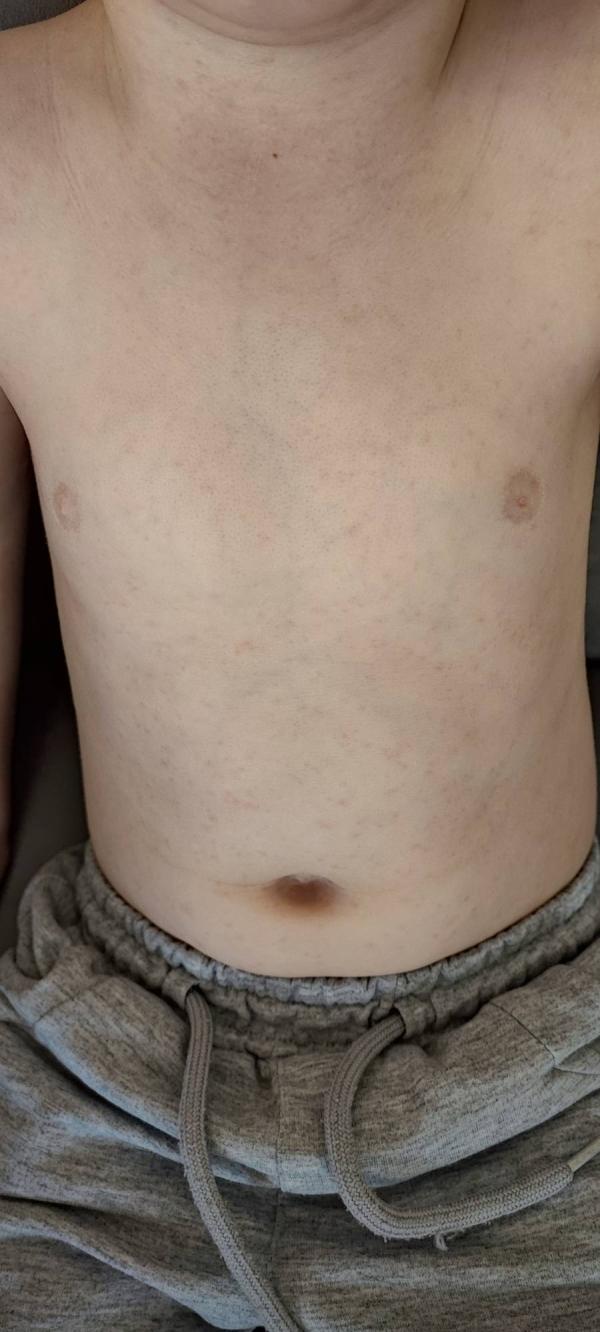 post image 1