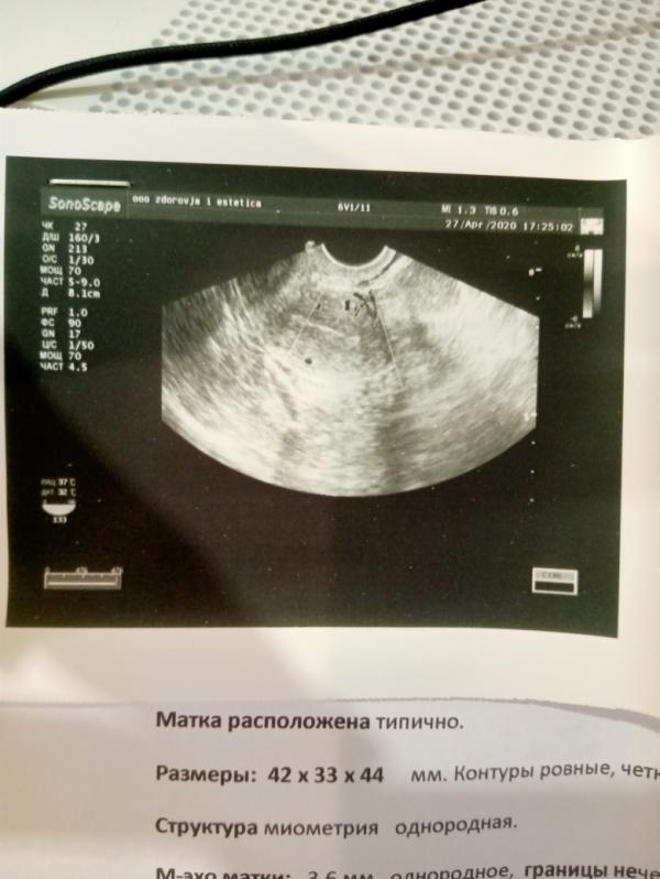 post image 4