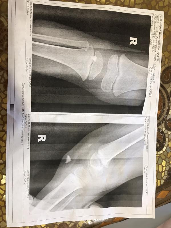 post image 4