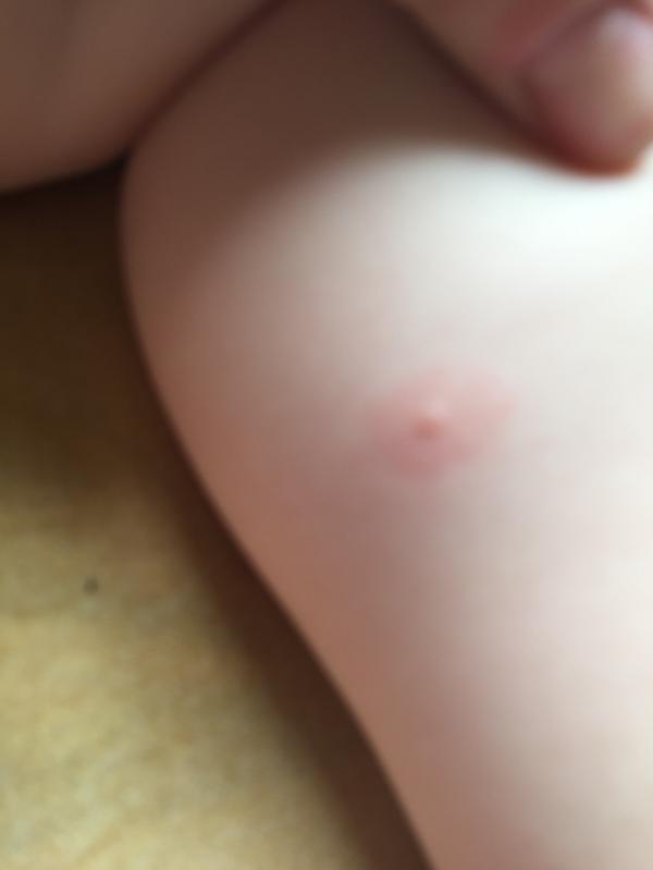 post image 4