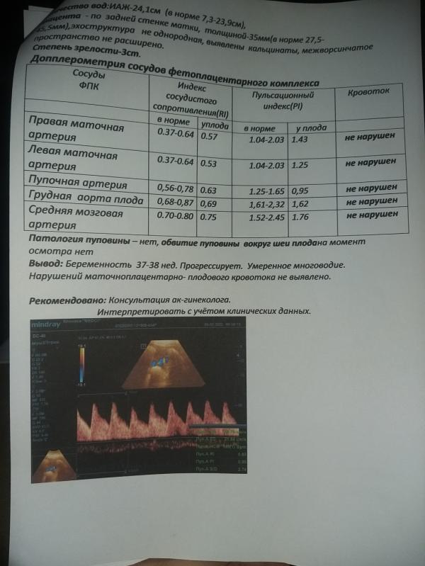 post image 4