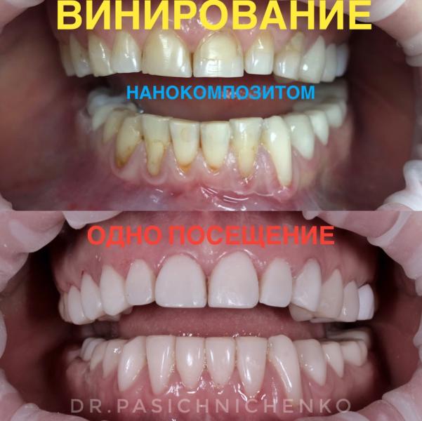 post image 4