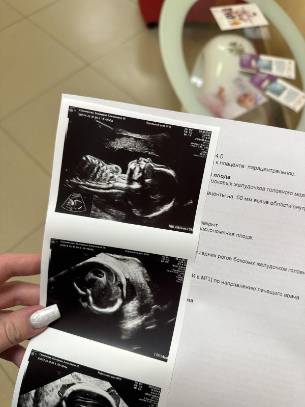post image 4
