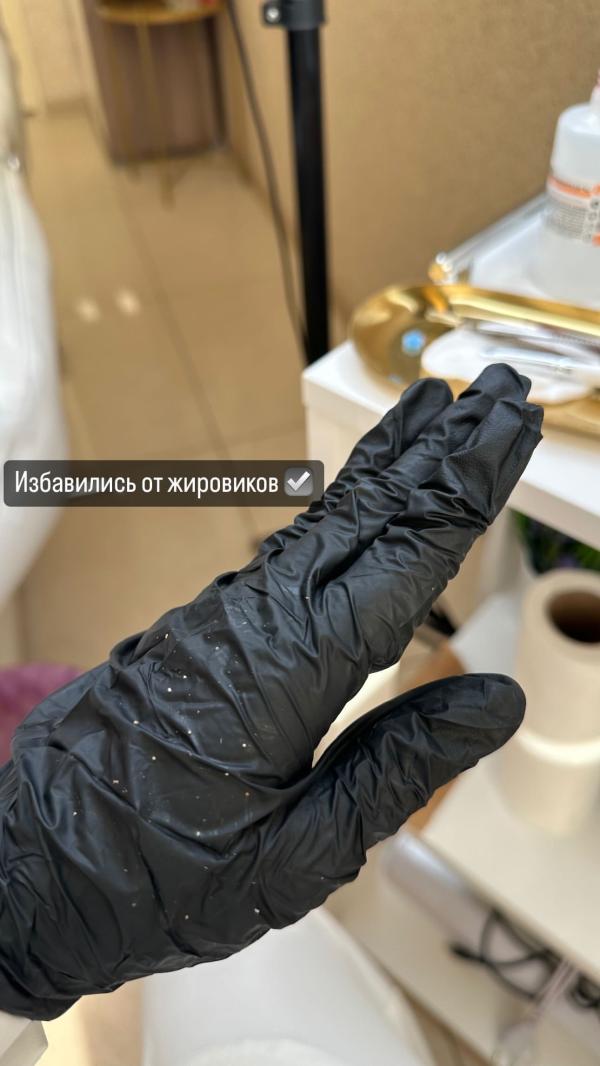 post image 4