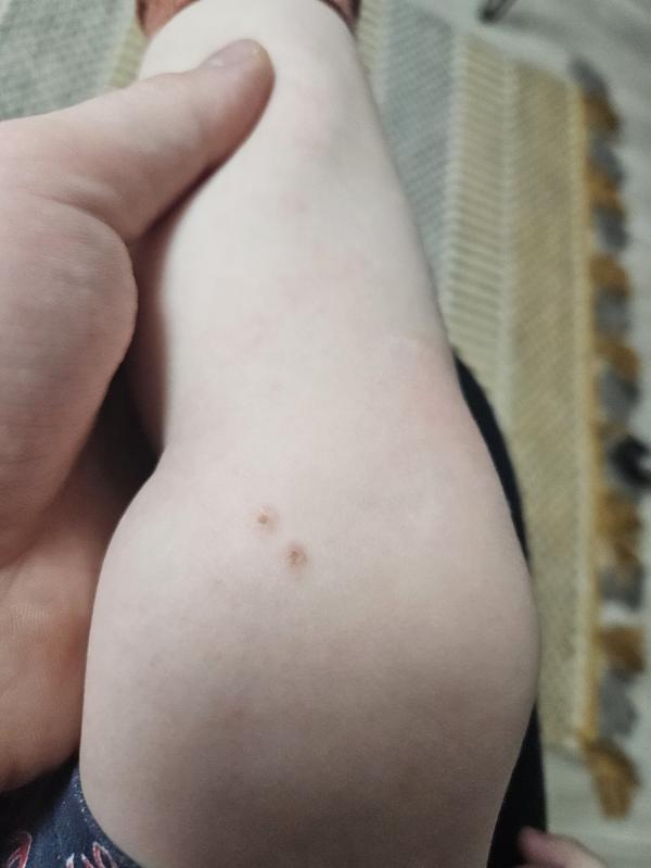 post image 4