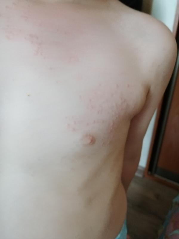 post image 2