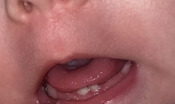 post image 4