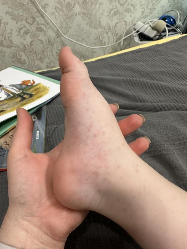 post image 2