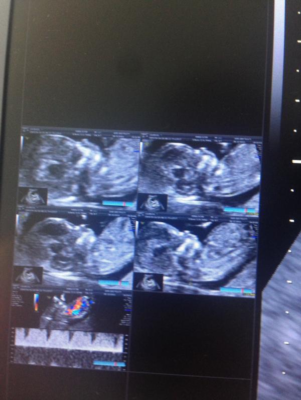 post image 4