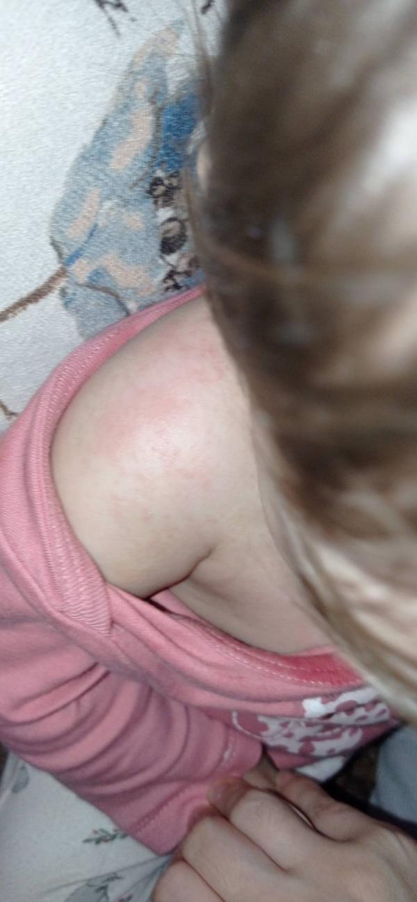 post image 2